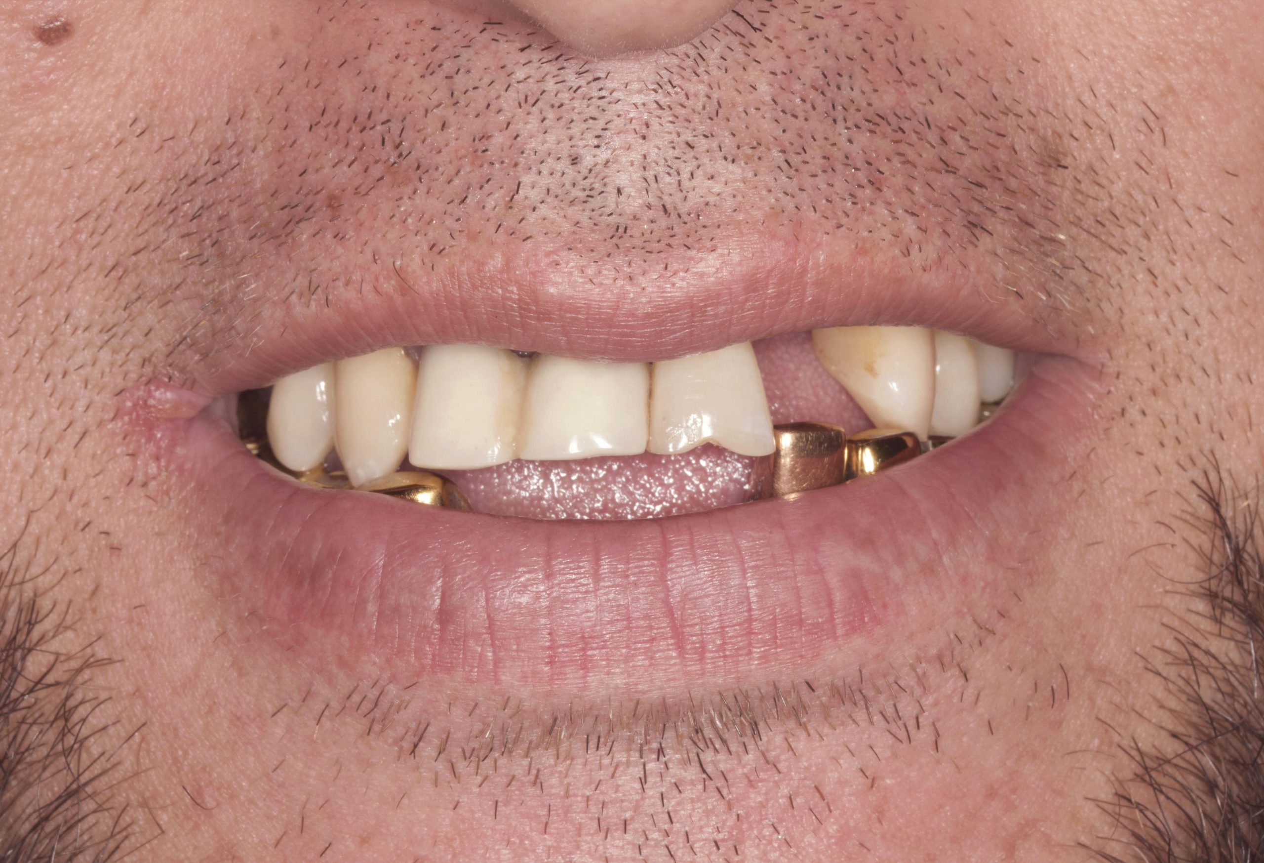 Before image