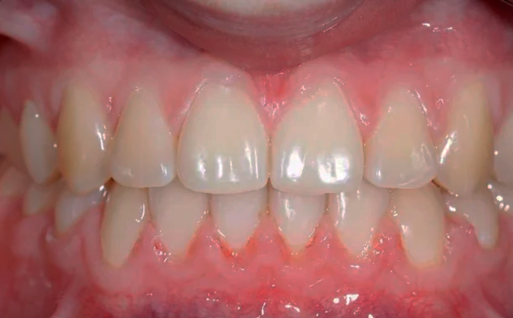 After image