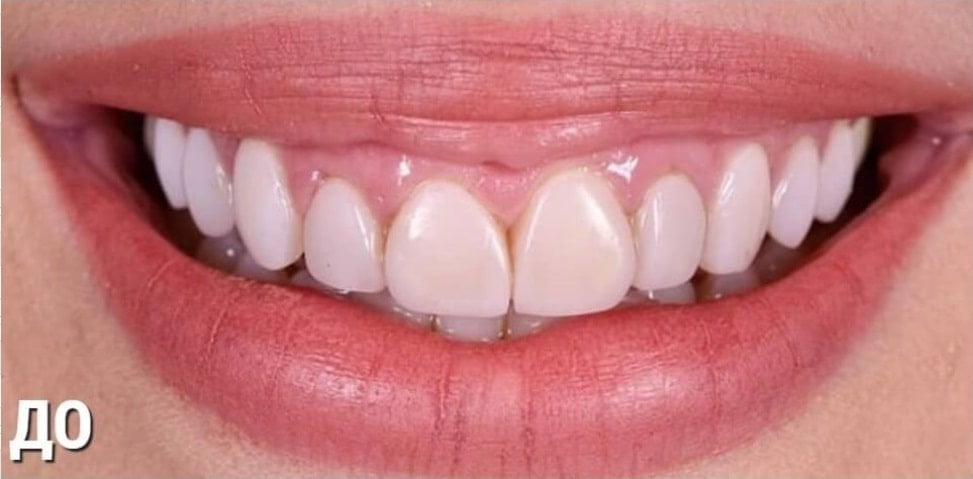 Before image
