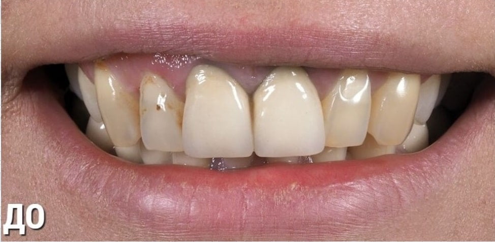 Before image